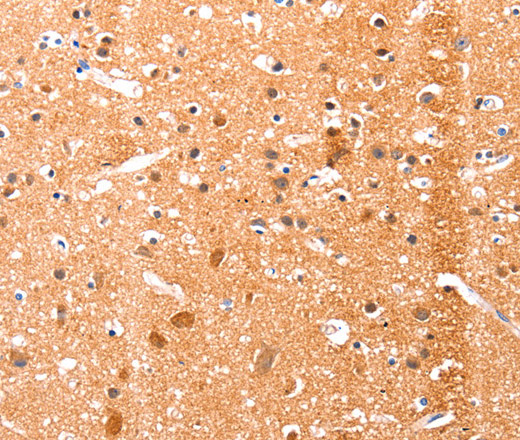 Ephrin A1 Polyclonal Antibody (E-AB-14062)
