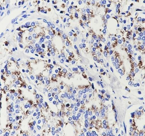 Recombinant SLC45A3 Monoclonal Antibody (AN301938L)