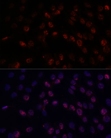 DDX24 Polyclonal Antibody (E-AB-65335)
