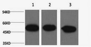 beta Tubulin Monoclonal Antibody (E-AB-20043)