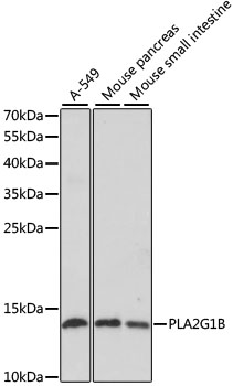 PLA2G1B Polyclonal Antibody (E-AB-67665)