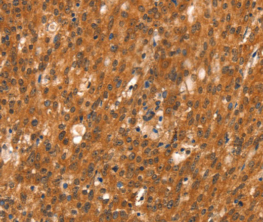 DAB2IP Polyclonal Antibody (E-AB-13183)
