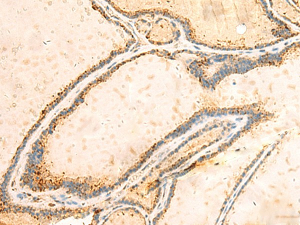 IGFBPL1 Polyclonal Antibody (E-AB-18105)