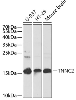 TNNC2 Polyclonal Antibody (E-AB-68409)
