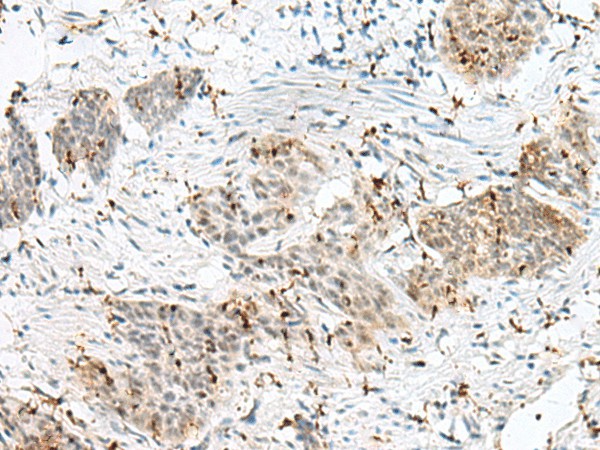 PLCL2 Polyclonal Antibody (E-AB-18878)