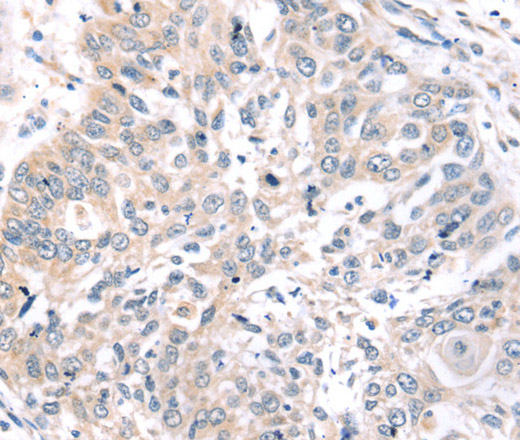 ROR1 Polyclonal Antibody (E-AB-13684)