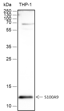 Recombinant S100A9 Monoclonal Antibody (AN301742L)
