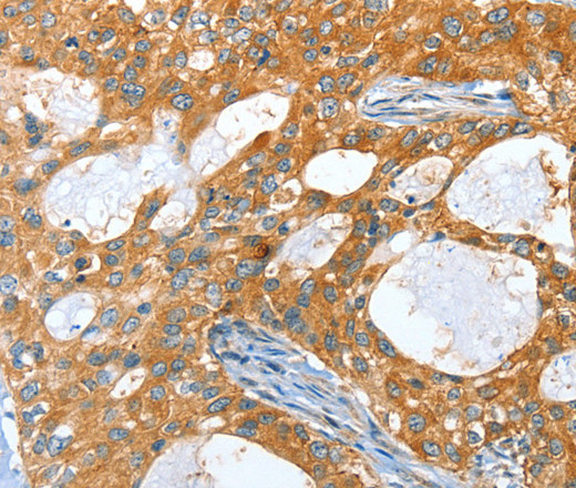 AMHR2 Polyclonal Antibody (E-AB-10789)