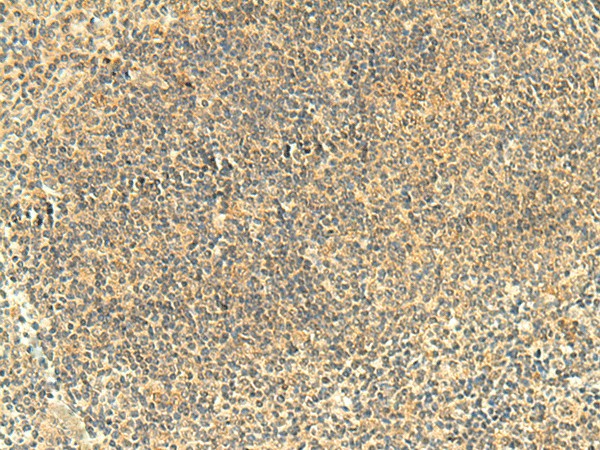 FMNL2 Polyclonal Antibody (E-AB-18919)