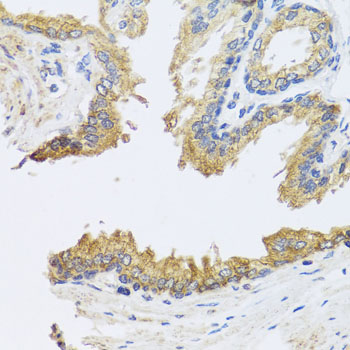 ARL6 Polyclonal Antibody (E-AB-62543)