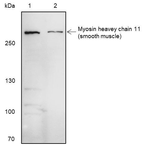Recombinant Smooth Muscle Myosin heavy chain 11 Monoclonal Antibody (AN301659L)