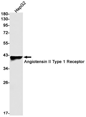 Recombinant Angiotensin II Type 1 Receptor Monoclonal Antibody (E-AB-81528)