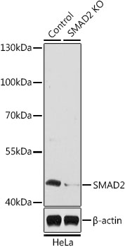 (KO Validated) SMAD2 Polyclonal Antibody (E-AB-62120)