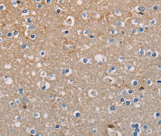 AMBRA1 Polyclonal Antibody (E-AB-10787)