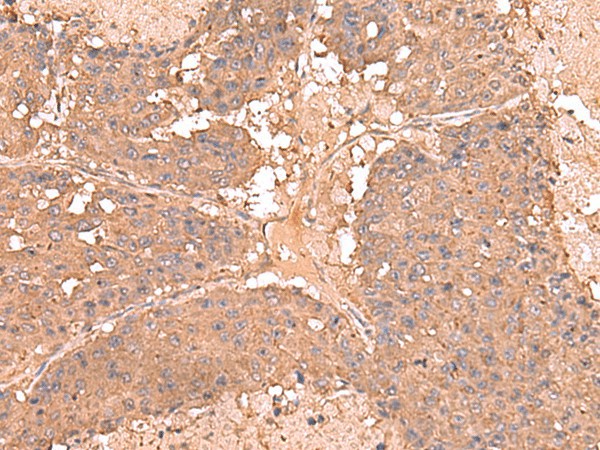 AHCYL1 Polyclonal Antibody (E-AB-52981)