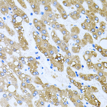 TOB2 Polyclonal Antibody (E-AB-62362)
