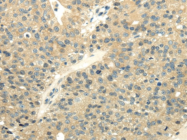 UBL4A Polyclonal Antibody (E-AB-17192)