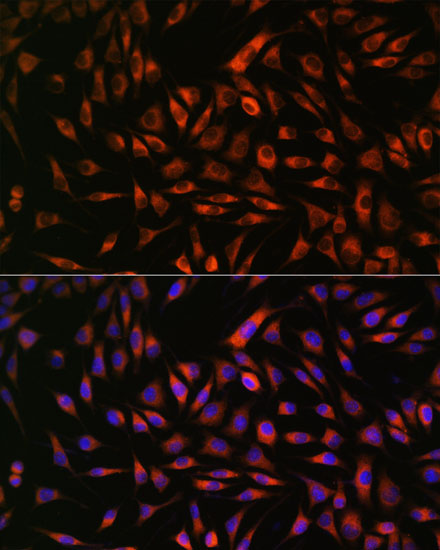 EML4 Polyclonal Antibody (E-AB-66695)