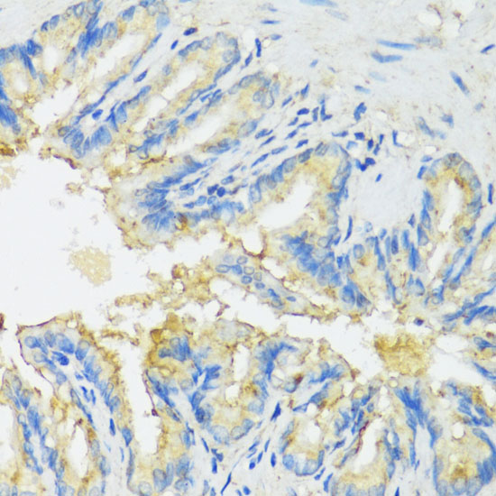 CYP11A1 Polyclonal Antibody (E-AB-66782)