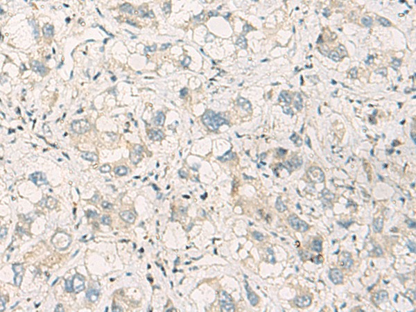 SPSB2 Polyclonal Antibody (E-AB-19206)