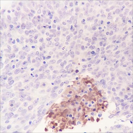 Recombinant Tenascin X Monoclonal Antibody (AN301672L)