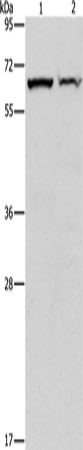 CBS Polyclonal Antibody (E-AB-14671)