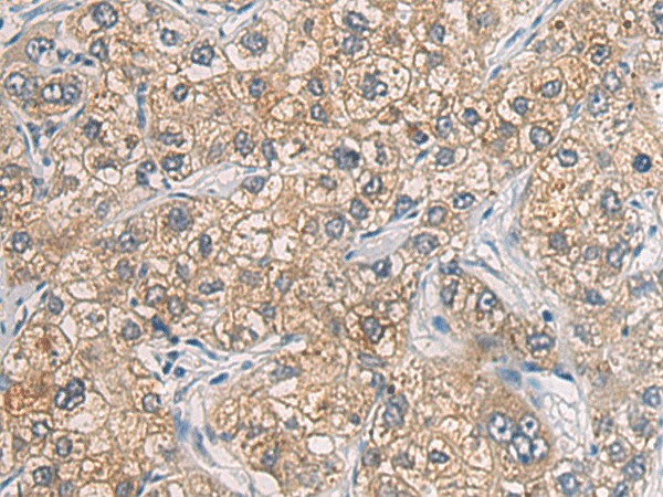 GAB4 Polyclonal Antibody (E-AB-17980)