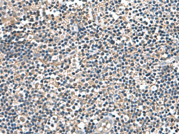 IP6K2 Polyclonal Antibody (E-AB-53012)