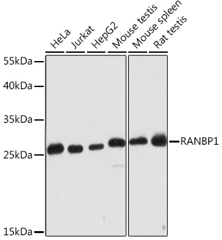 RANBP1 Polyclonal Antibody (E-AB-91524)