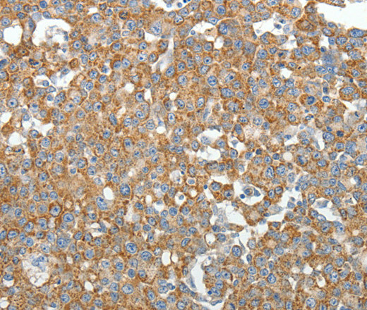 GEMIN2 Polyclonal Antibody (E-AB-12645)