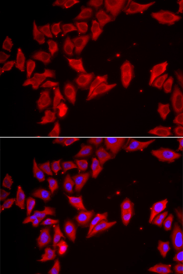 SLC35A2 Polyclonal Antibody (E-AB-61598)