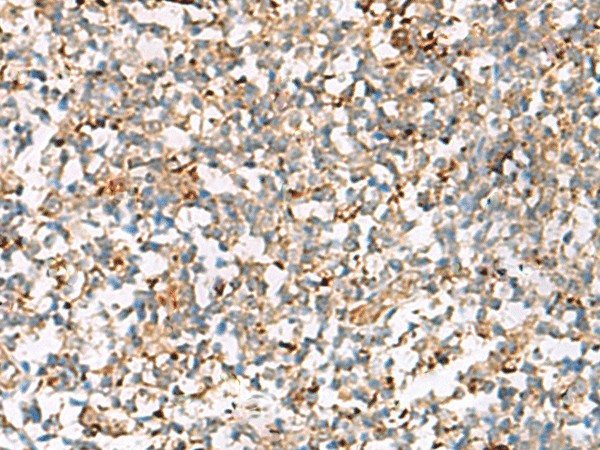 NPC2 Polyclonal Antibody (E-AB-52814)