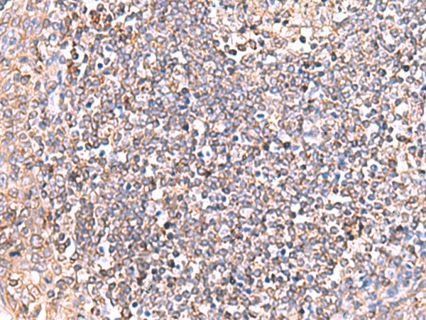GRIA2 Polyclonal Antibody (E-AB-18121)