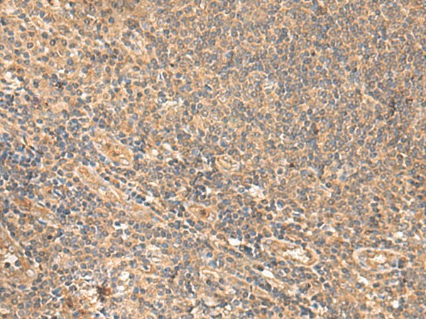 MEST Polyclonal Antibody (E-AB-18986)