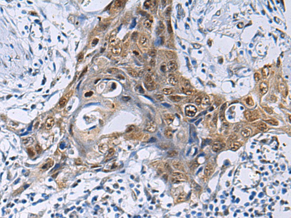 THOC3 Polyclonal Antibody (E-AB-53164)