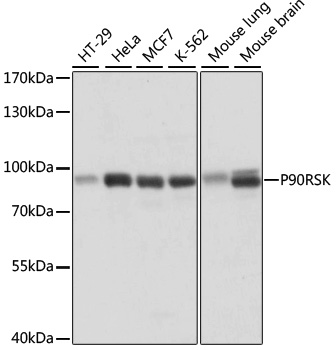 P90RSK Polyclonal Antibody (E-AB-66546)