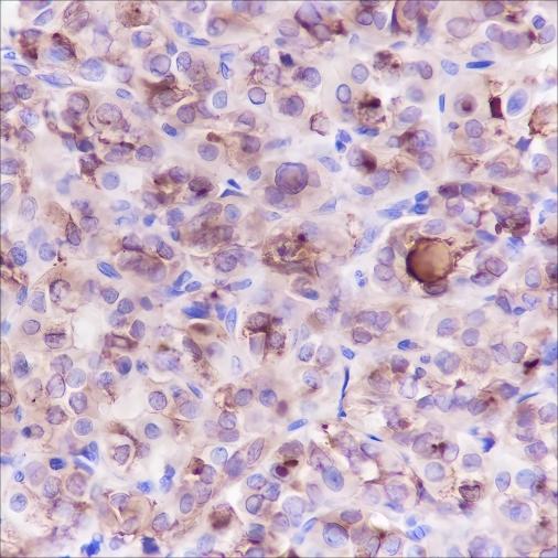 Recombinant Thyroglobulin Monoclonal Antibody (AN301675L)