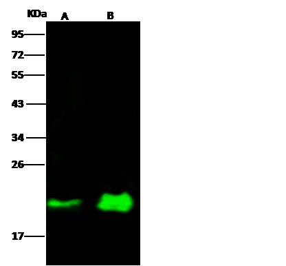 NRAS/N-Ras Monoclonal Antibody (AN200076P)