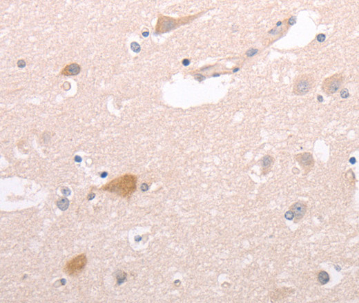 CIDEB Polyclonal Antibody (E-AB-10667)