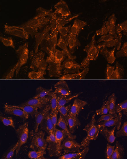 HSD17B8 Polyclonal Antibody (E-AB-64392)