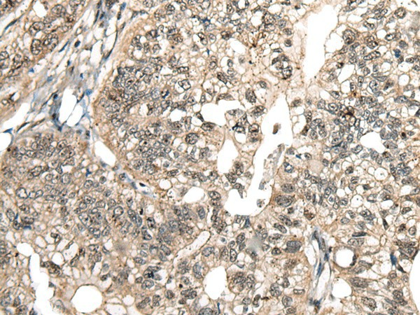 MCPH1 Polyclonal Antibody (E-AB-18549)