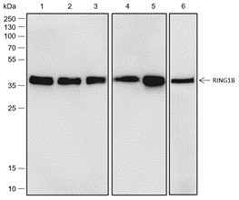 Recombinant RING1B Monoclonal Antibody (AN301819L)
