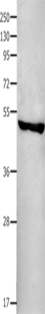 FAS Polyclonal Antibody (E-AB-13830)