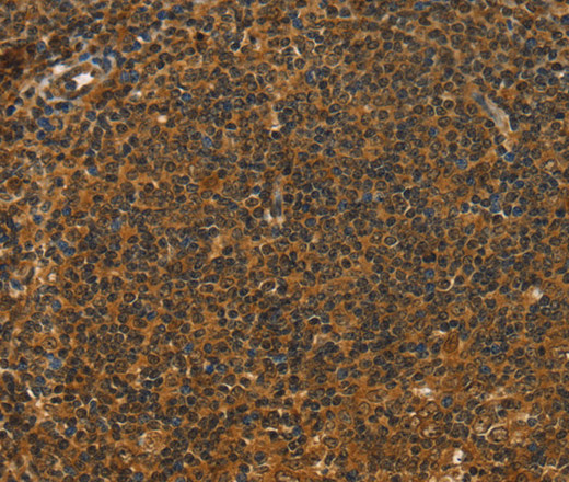 STAR Polyclonal Antibody (E-AB-11610)