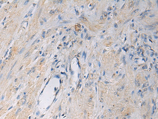 HSDL2 Polyclonal Antibody (E-AB-19241)
