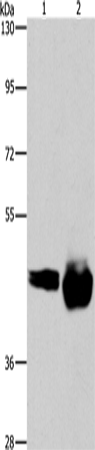 CD38 Polyclonal Antibody (E-AB-16317)
