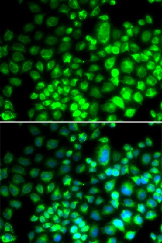 ST6GAL1 Polyclonal Antibody (E-AB-65920)