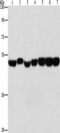 ENO1 Polyclonal Antibody (E-AB-11010)