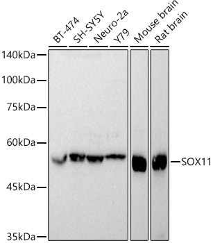 SOX11 Polyclonal Antibody (E-AB-91961)