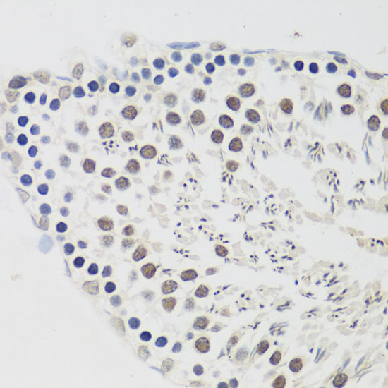CCNE2 Polyclonal Antibody (E-AB-67610)